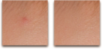 Ch11-Fig-15-Spot-Healing-2.png Ch11-Fig-15-Spot-Healing-2.png
